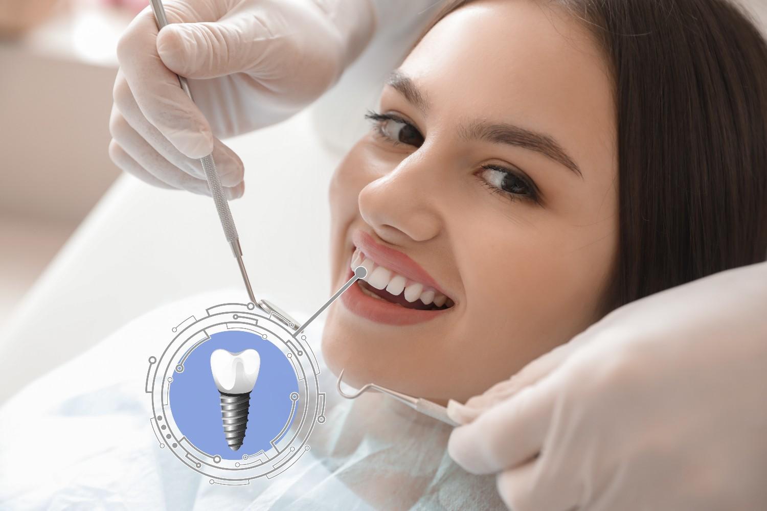 What are Dental Implants? Types, Procedure & Safety
