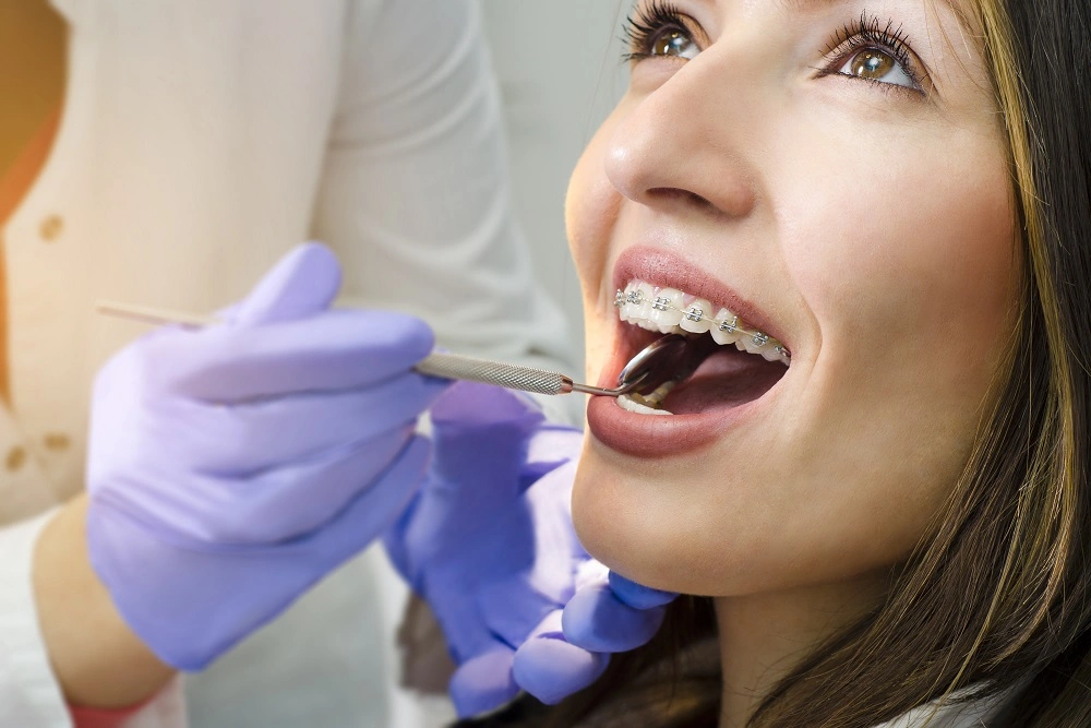 How Much Do Braces Cost?