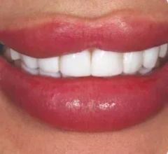 After Restorative and cosmetic treatments 1