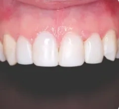 After Restorative and cosmetic treatments