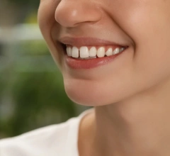 Before Invisalign 1