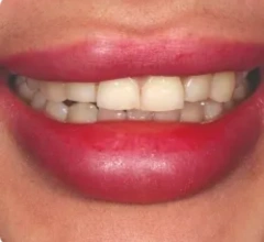Before Restorative and cosmetic treatments 1