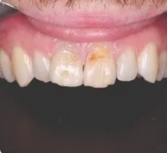 Before Restorative and cosmetic treatments