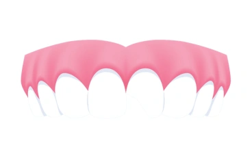 Chipped or Broken Teeth