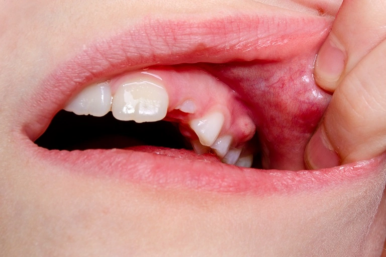 Top 7 Tips to Keep Your Child’s Enamel Strong