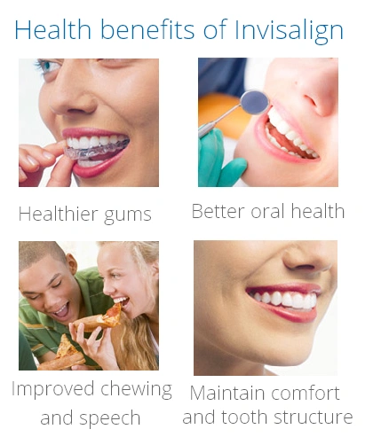 Health Benefits of Invisalign
