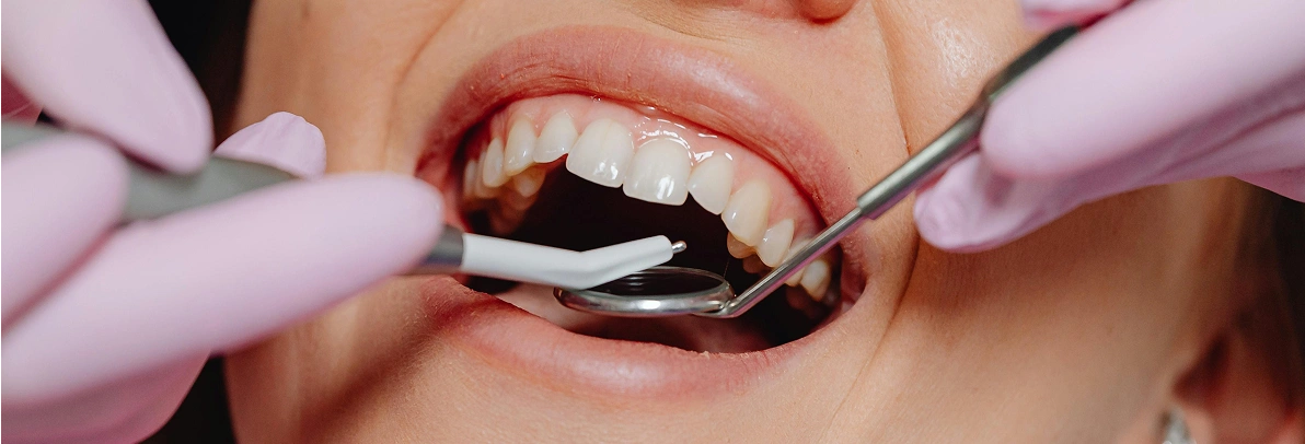 Hygienist cost
