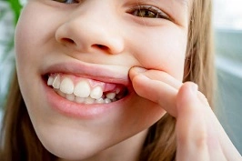Kids Tooth Eruption: Before, During and After – Things to Know
