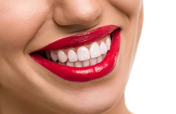 How To Deal With the Space Between Your Front Teeth