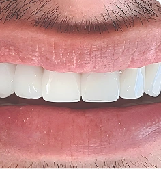 Rectangle 4608 1
