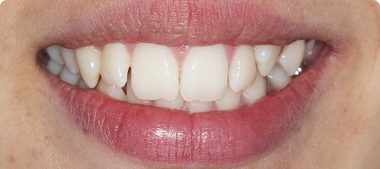  before