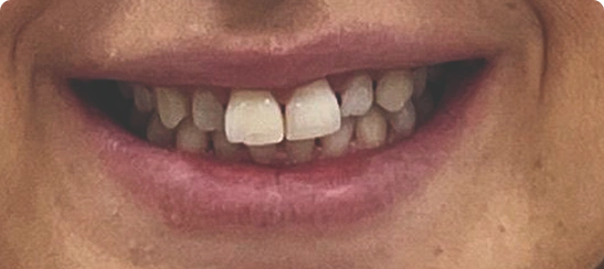  before