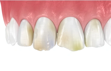 Stubborn Discolouration