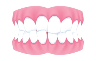 Uneven Tooth Edges
