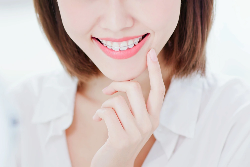 How Much Do Retainers Cost?