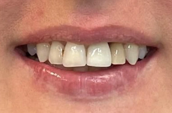 A1