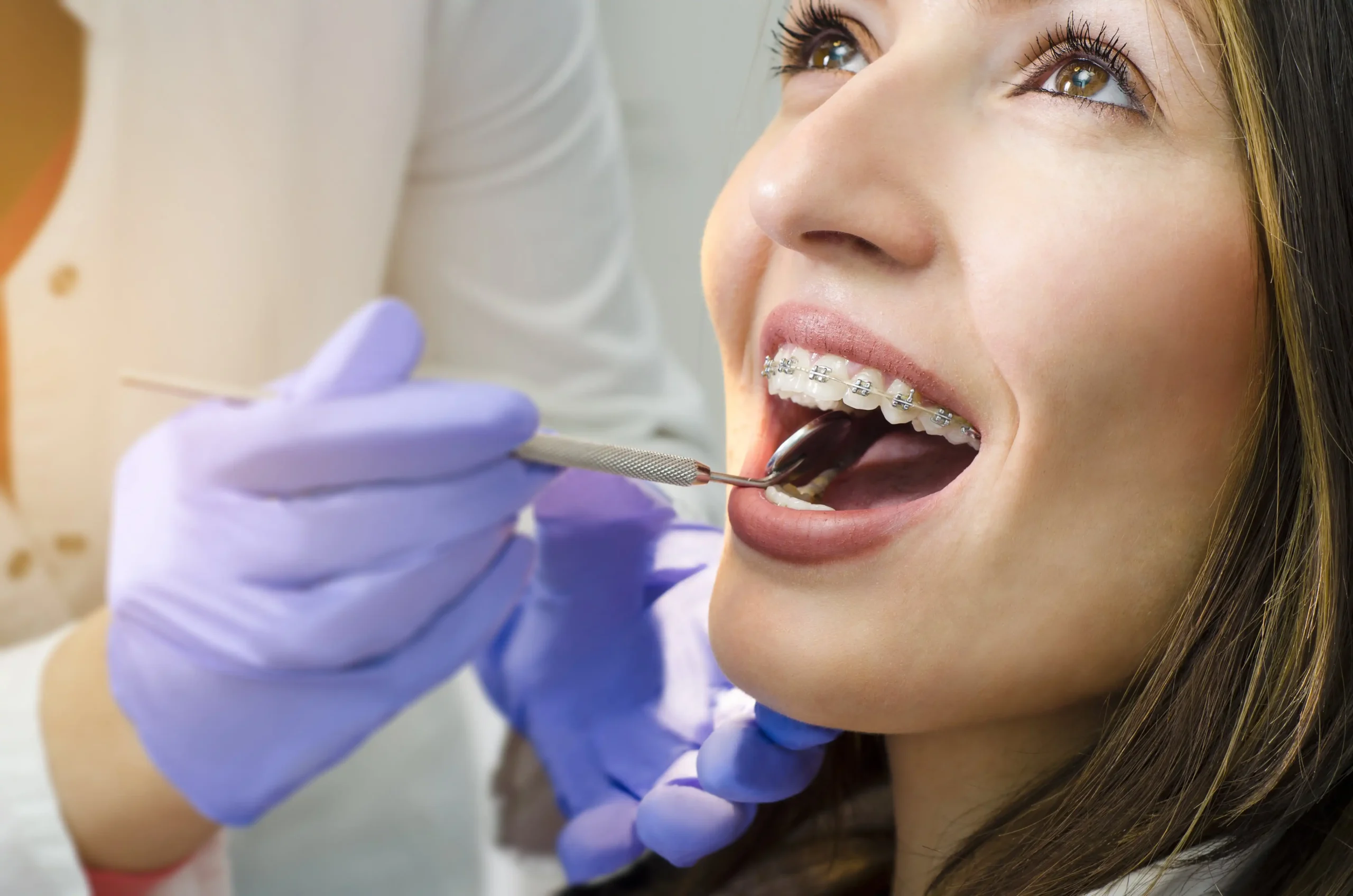 Braces Treatment