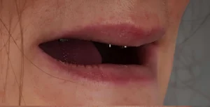 Before Dental Treatment