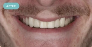 Bridge Dental After