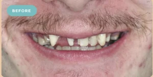 Bridge Dental After