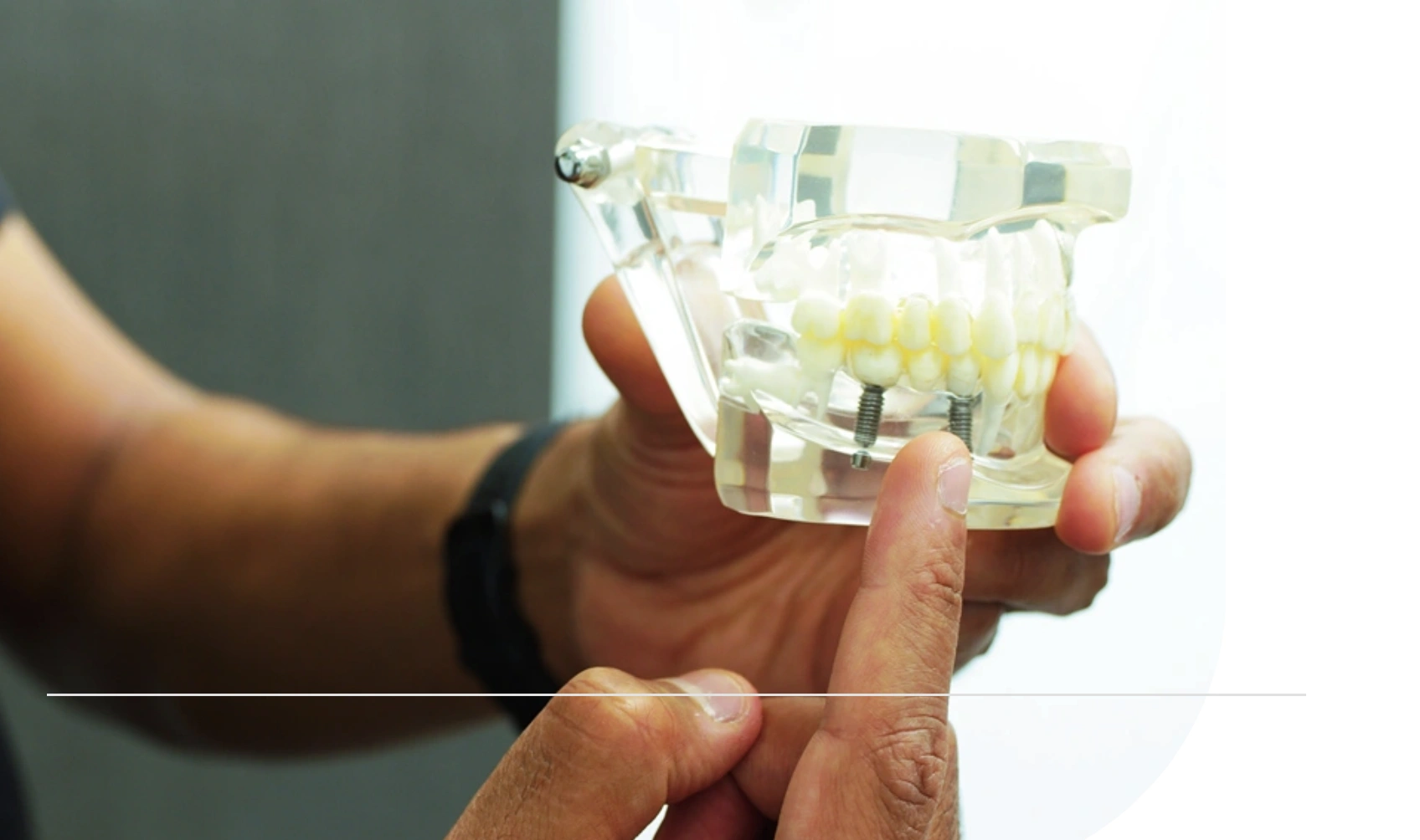 Dental Implant