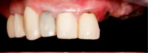 Multiple Dental