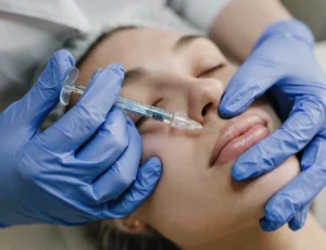 Swelling After Lip Filler