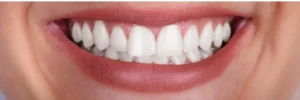 tooth