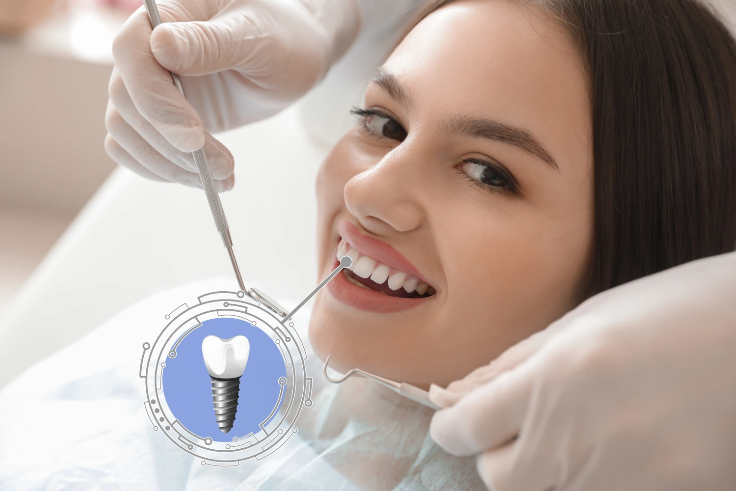 Dental Implant Before After: Realistic Smile Transformations & What To Expect